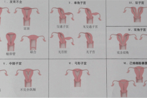 宫腔环境检查