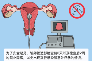 输卵管造影