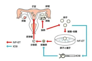 试管人工周期