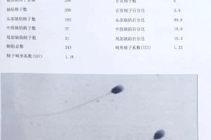 精子浓度
