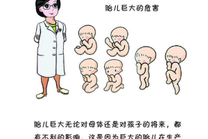 巨大儿