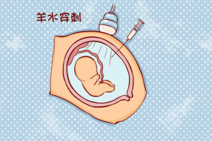 羊水穿刺